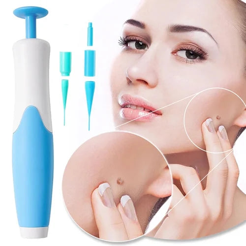 Premium Skin Tag & Mole Remover – Safe, Painless & Effective Solution