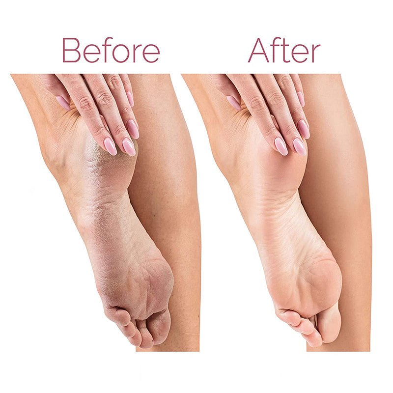 Electric Callus Remover & Pedicure Foot File for Silky-Smooth Feet