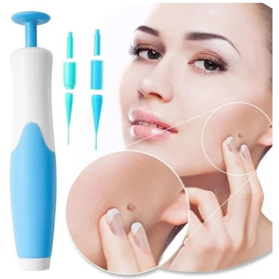 Premium Skin Tag & Mole Remover – Safe, Painless & Effective Solution