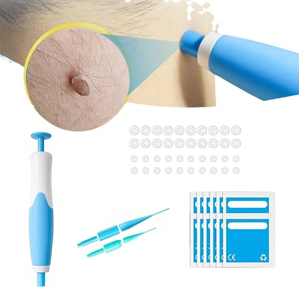 Premium Skin Tag & Mole Remover – Safe, Painless & Effective Solution
