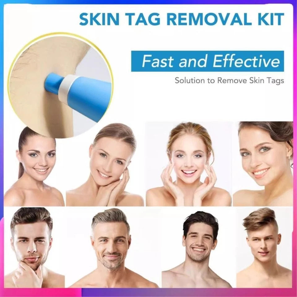 Premium Skin Tag & Mole Remover – Safe, Painless & Effective Solution